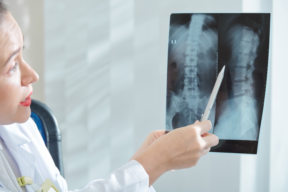 Diagnosing Spinal Stenosis
