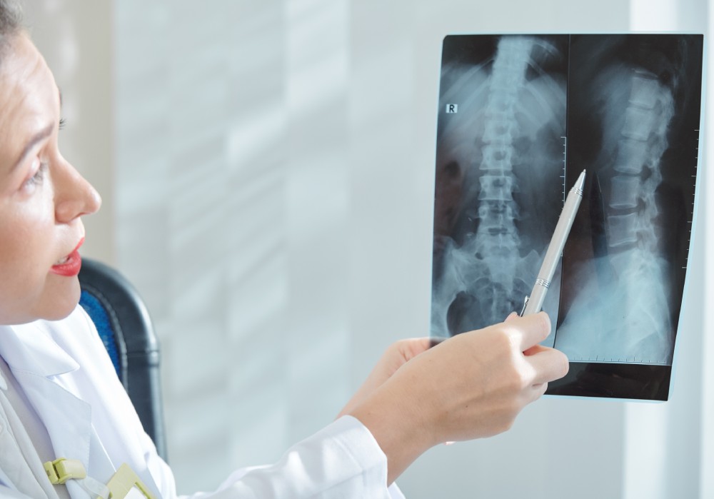 Spinal Tumor Treatments